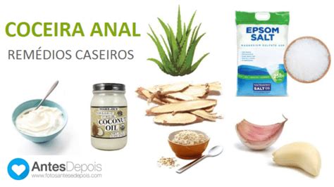 caseiro anal|anal.